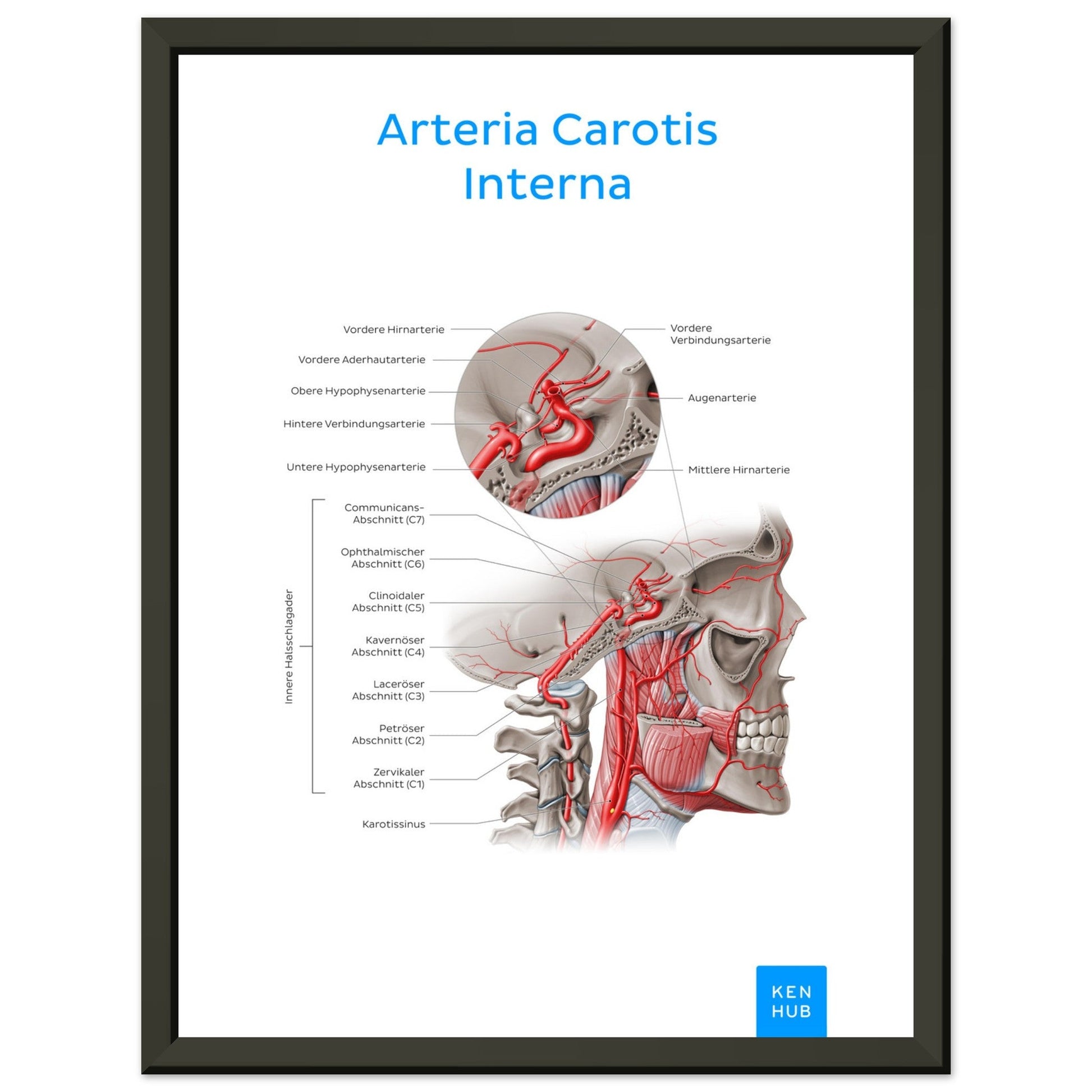 Arteria Carotis Interna (Deutsch) #poster# by ARTEXPRESSO