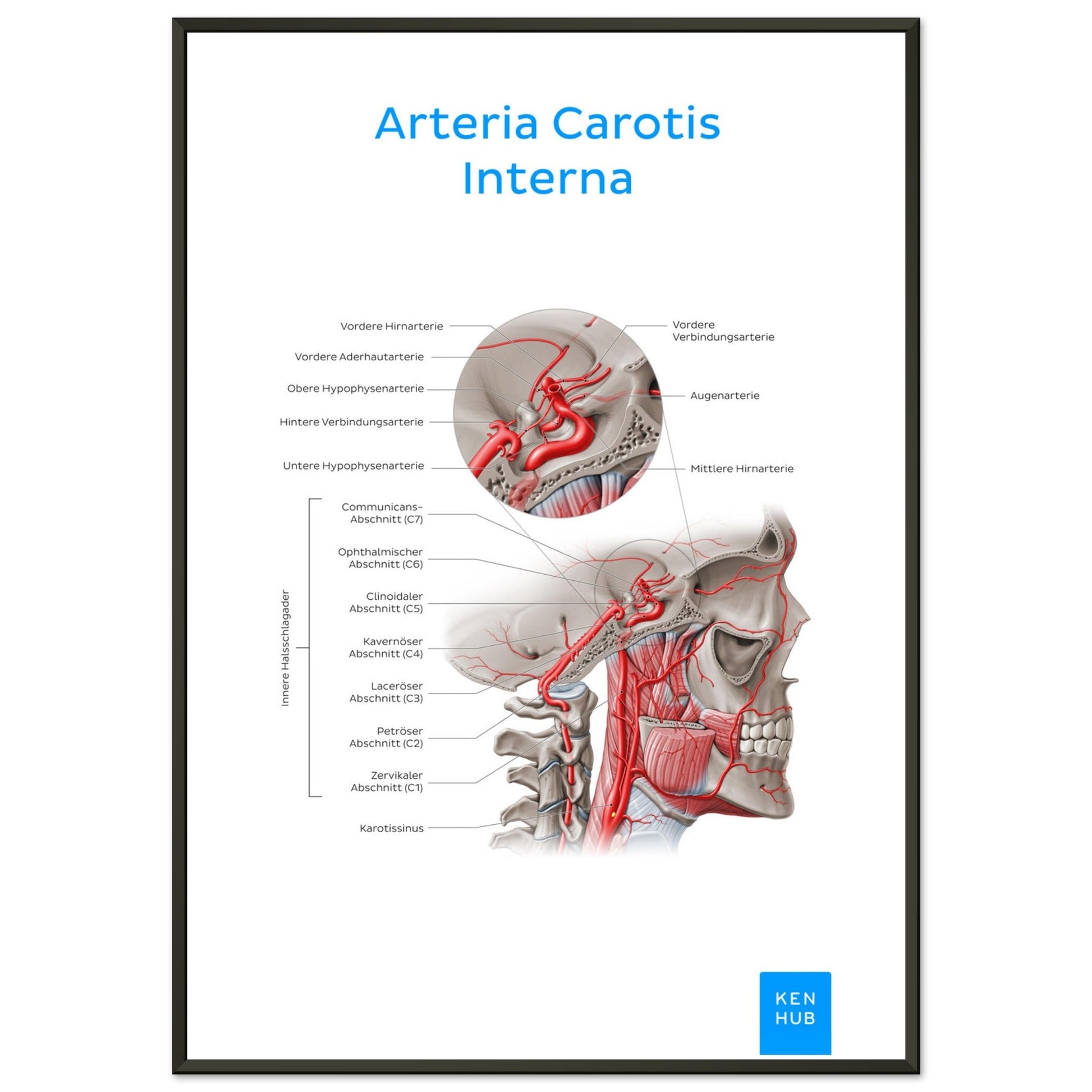 Arteria Carotis Interna (Deutsch) #poster# by ARTEXPRESSO