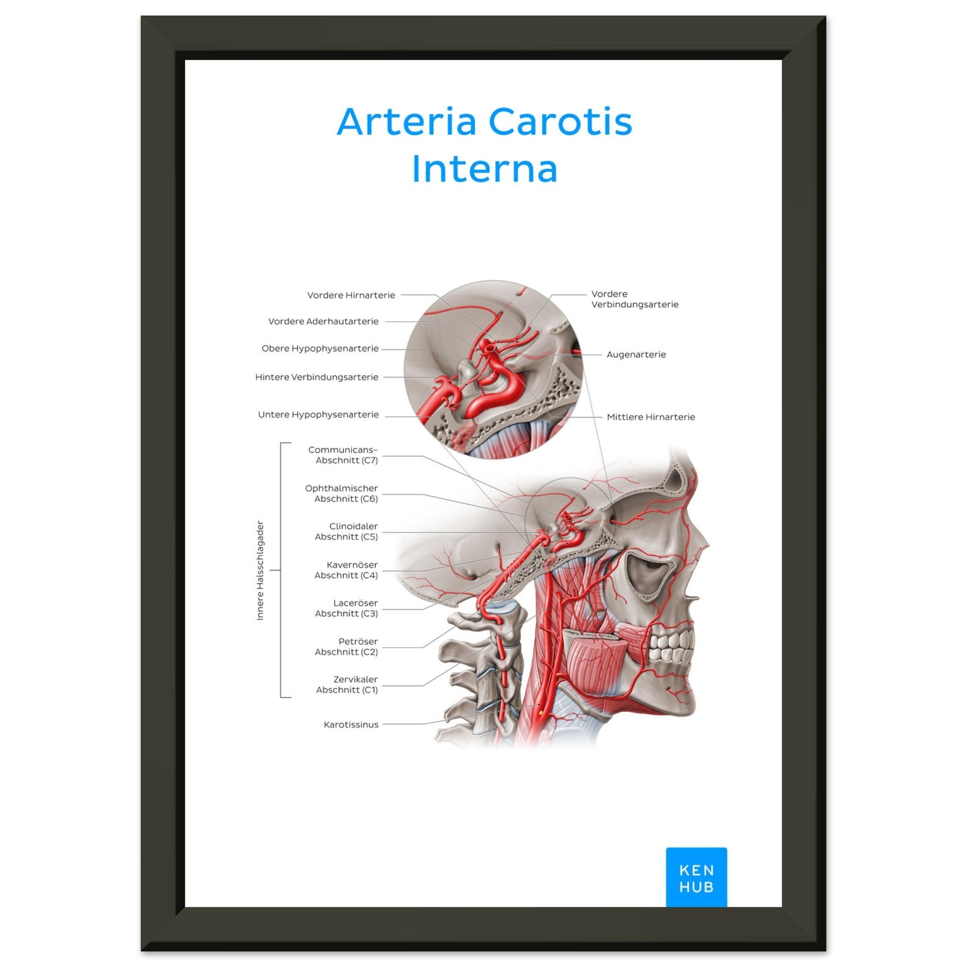 Arteria Carotis Interna (Deutsch) #poster# by ARTEXPRESSO