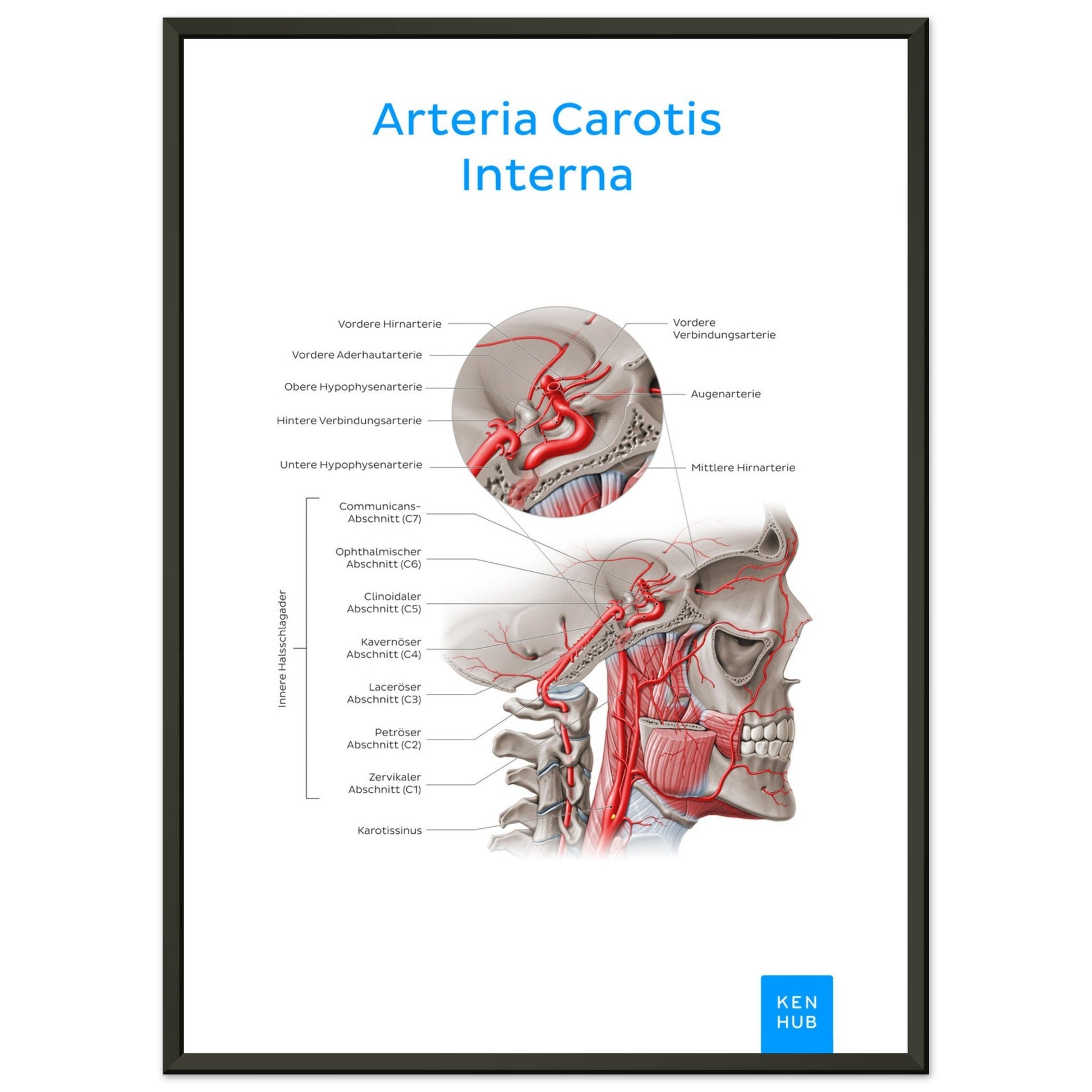 Arteria Carotis Interna (Deutsch) #poster# by ARTEXPRESSO