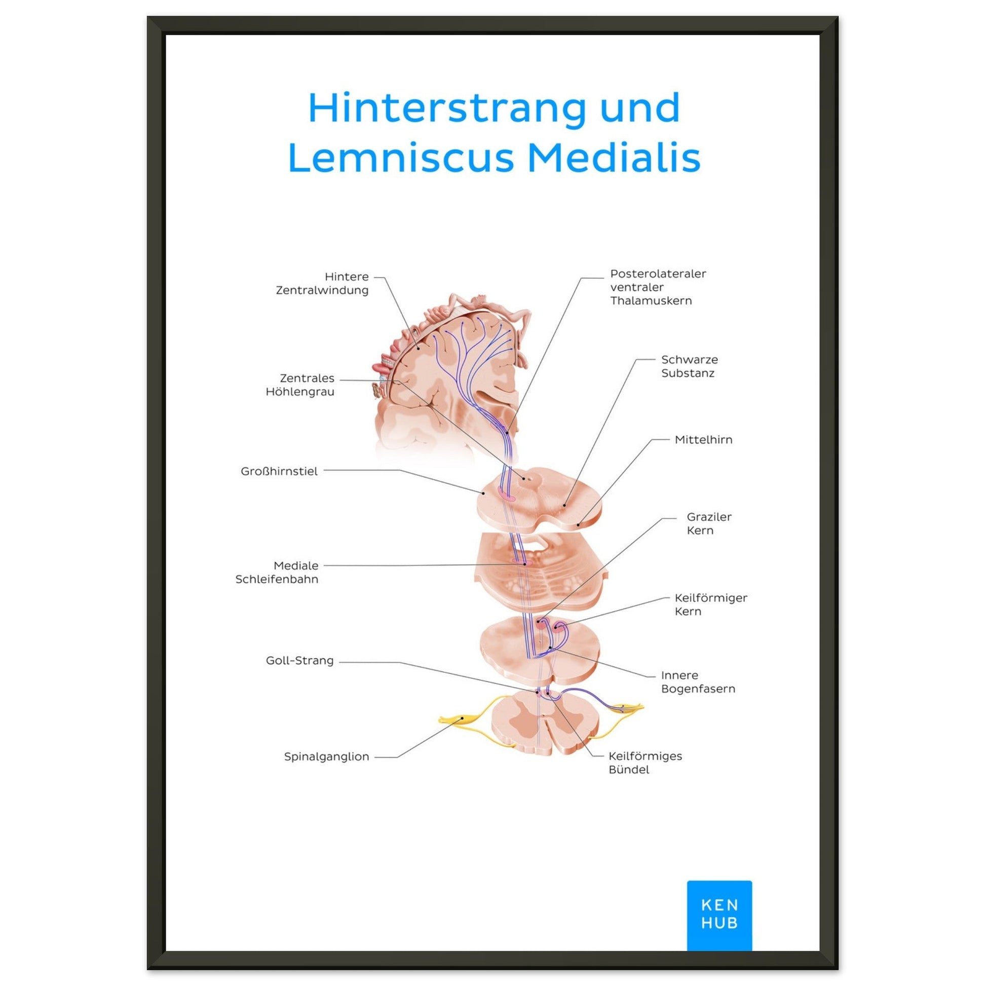 Hinterstrang und Lemniscus Medialis (Deutsch) #poster# by ARTEXPRESSO