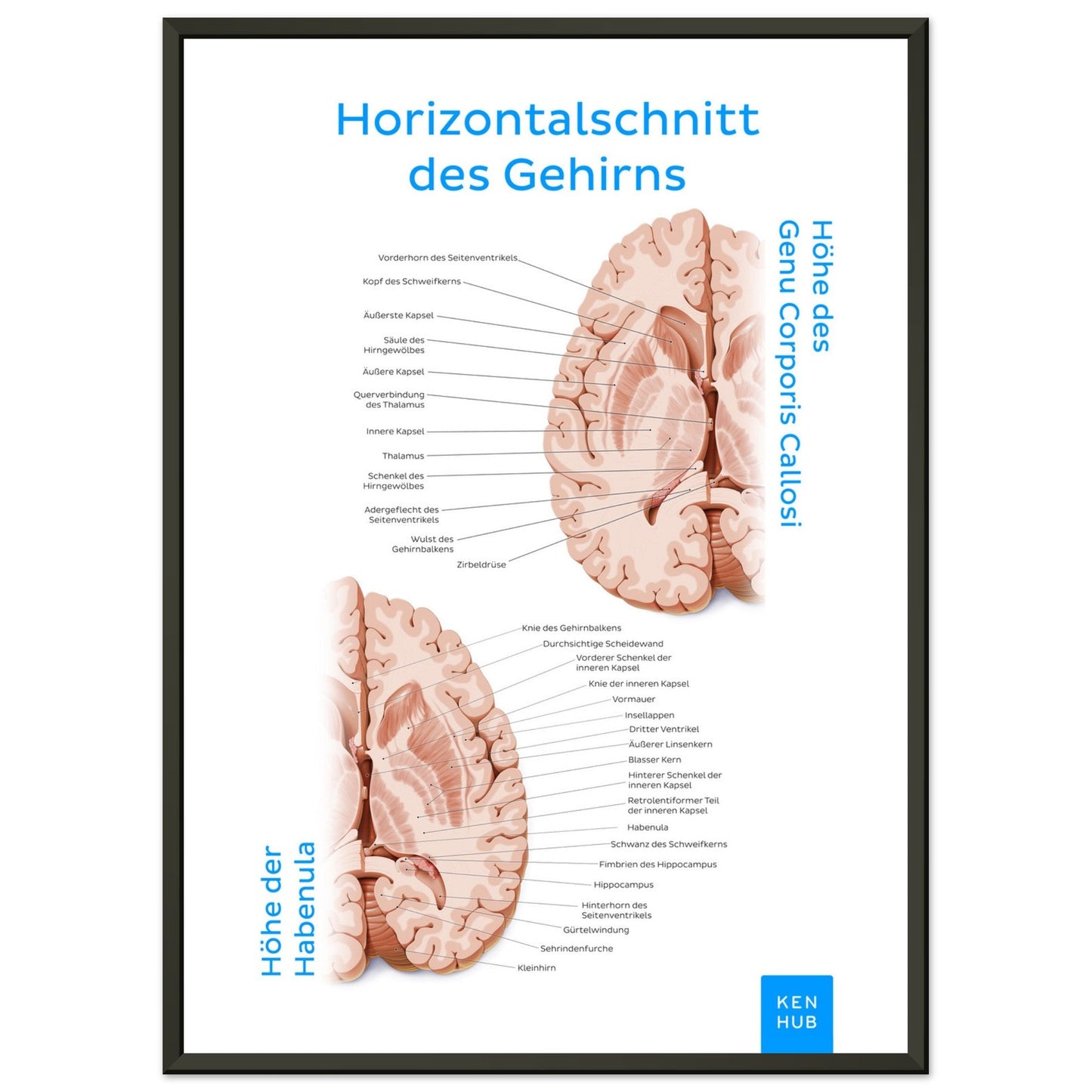 Horizontalschnitt des Gehirns (Deutsch) #poster# by ARTEXPRESSO