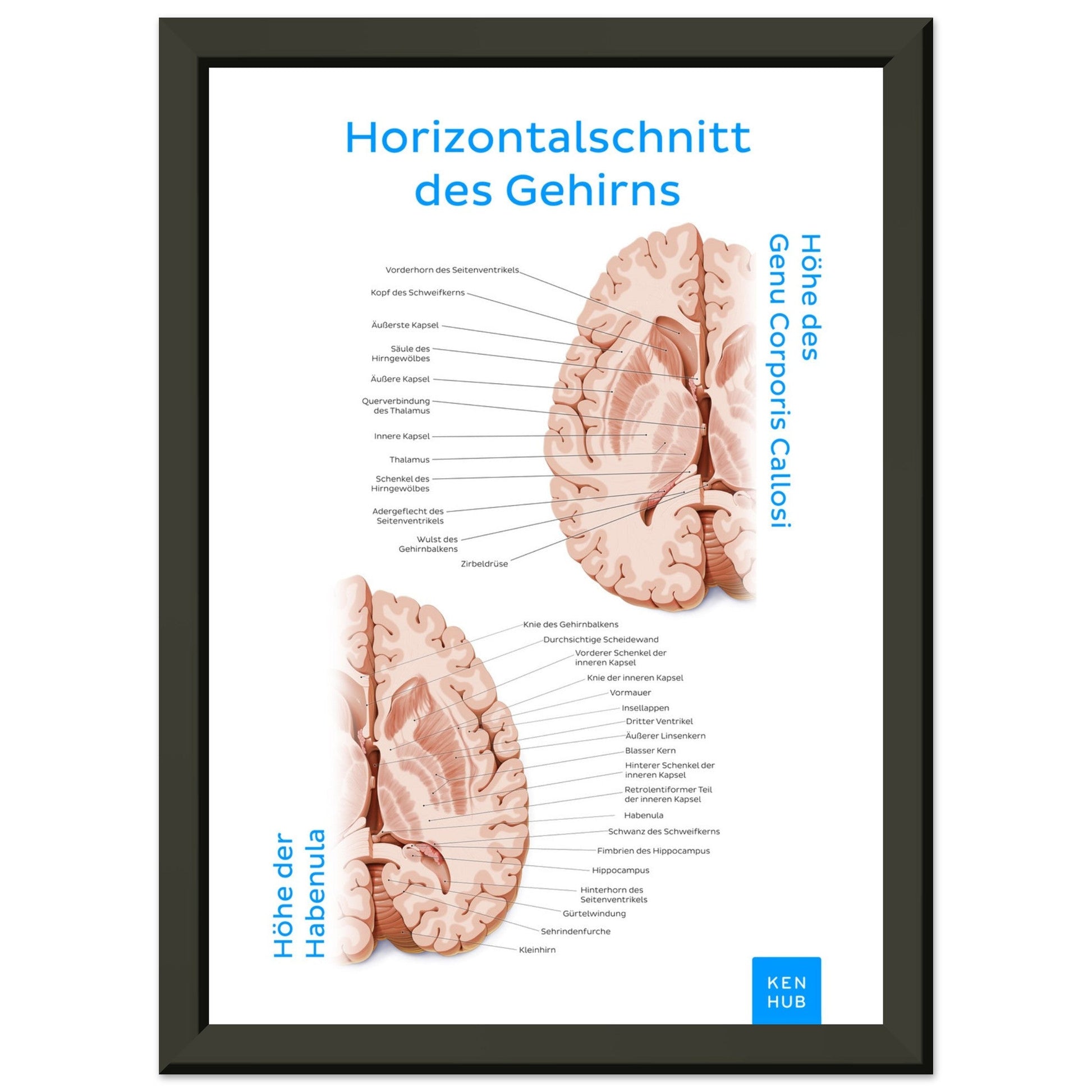 Horizontalschnitt des Gehirns (Deutsch) #poster# by ARTEXPRESSO