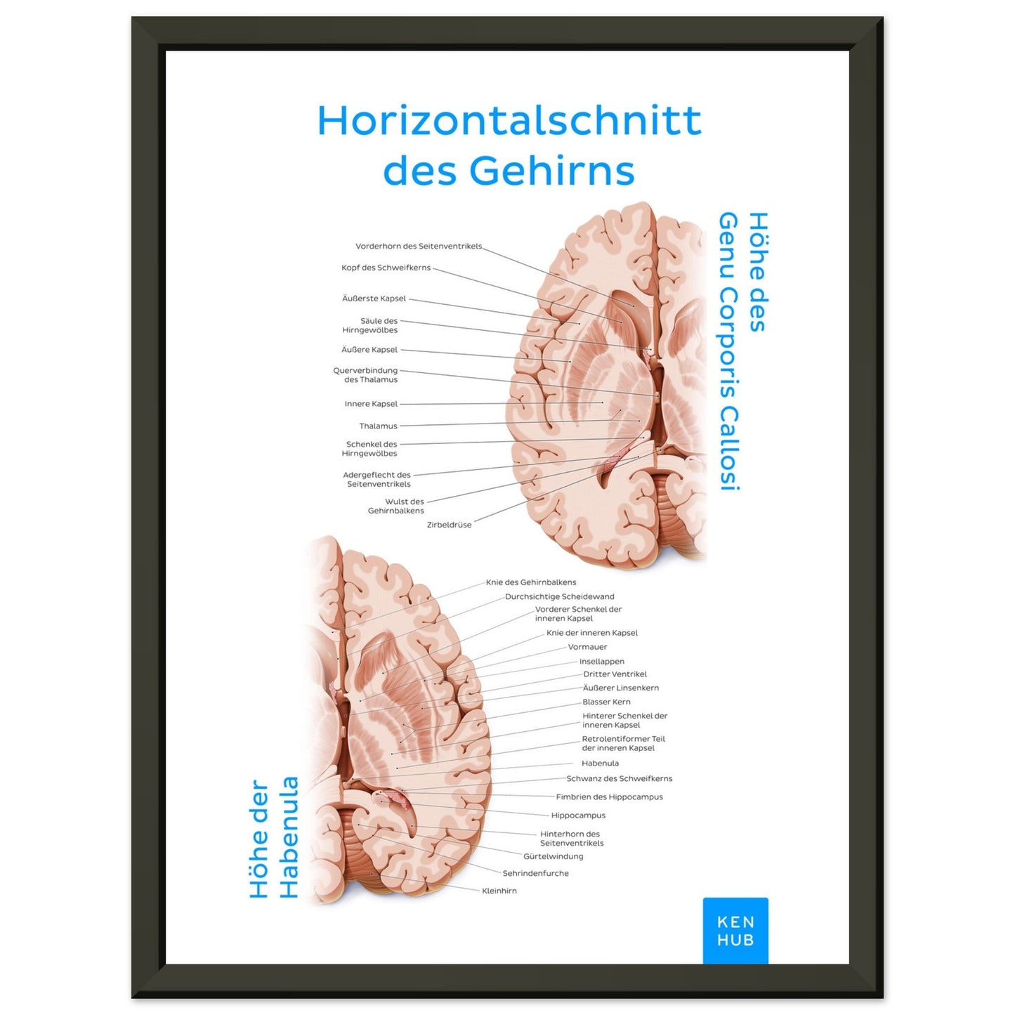 Horizontalschnitt des Gehirns (Deutsch) #poster# by ARTEXPRESSO