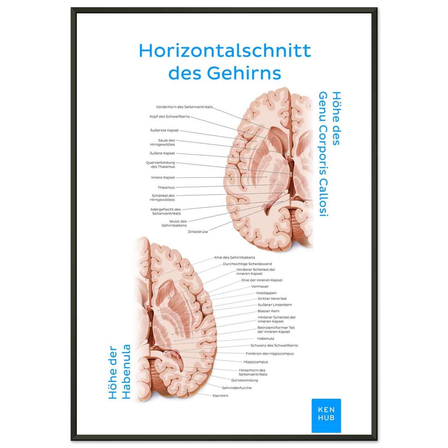 Horizontalschnitt des Gehirns (Deutsch) #poster# by ARTEXPRESSO