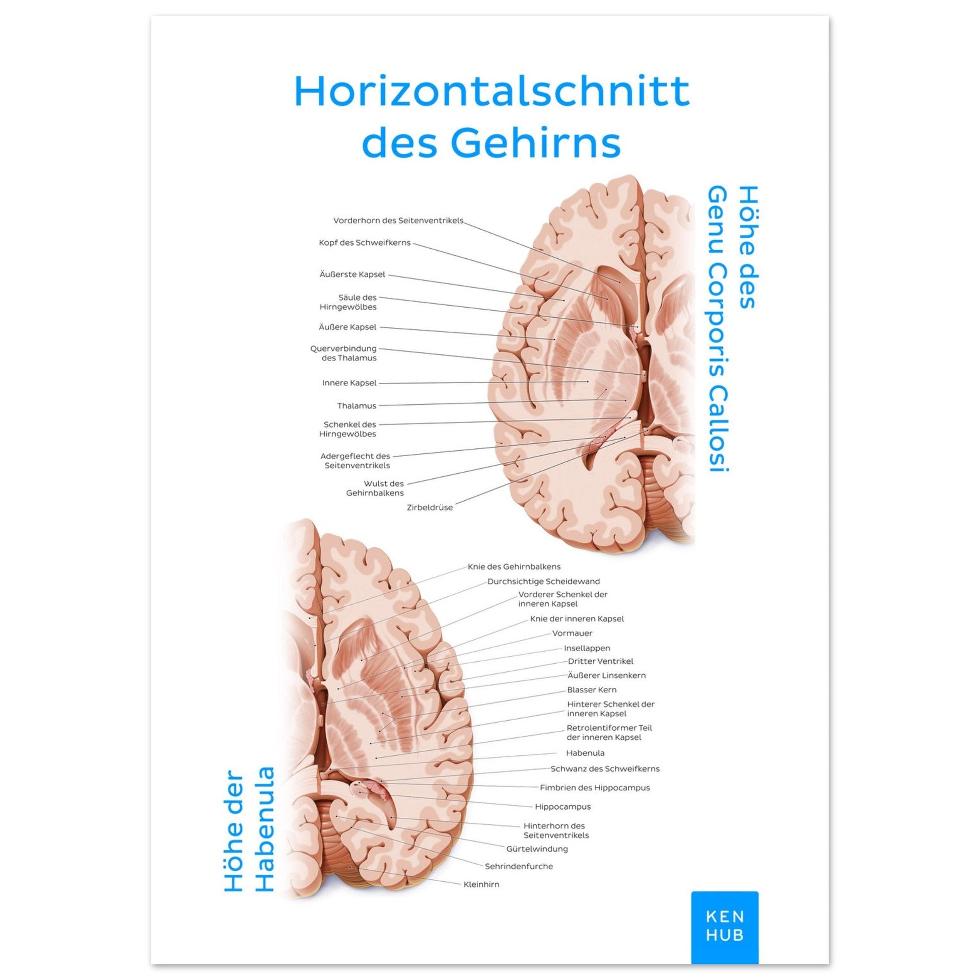 Horizontalschnitt des Gehirns (Deutsch) #poster# by ARTEXPRESSO