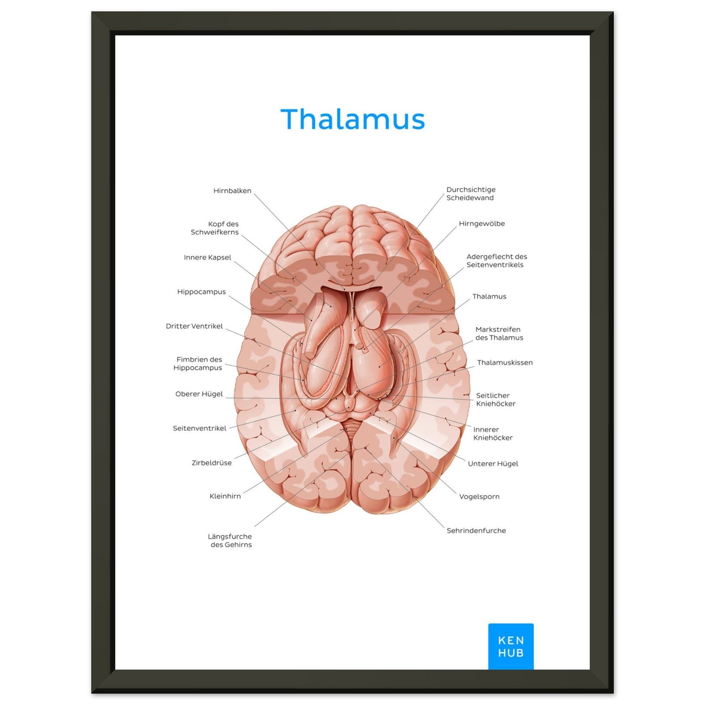 Thalamus (Deutsch) #poster# by ARTEXPRESSO