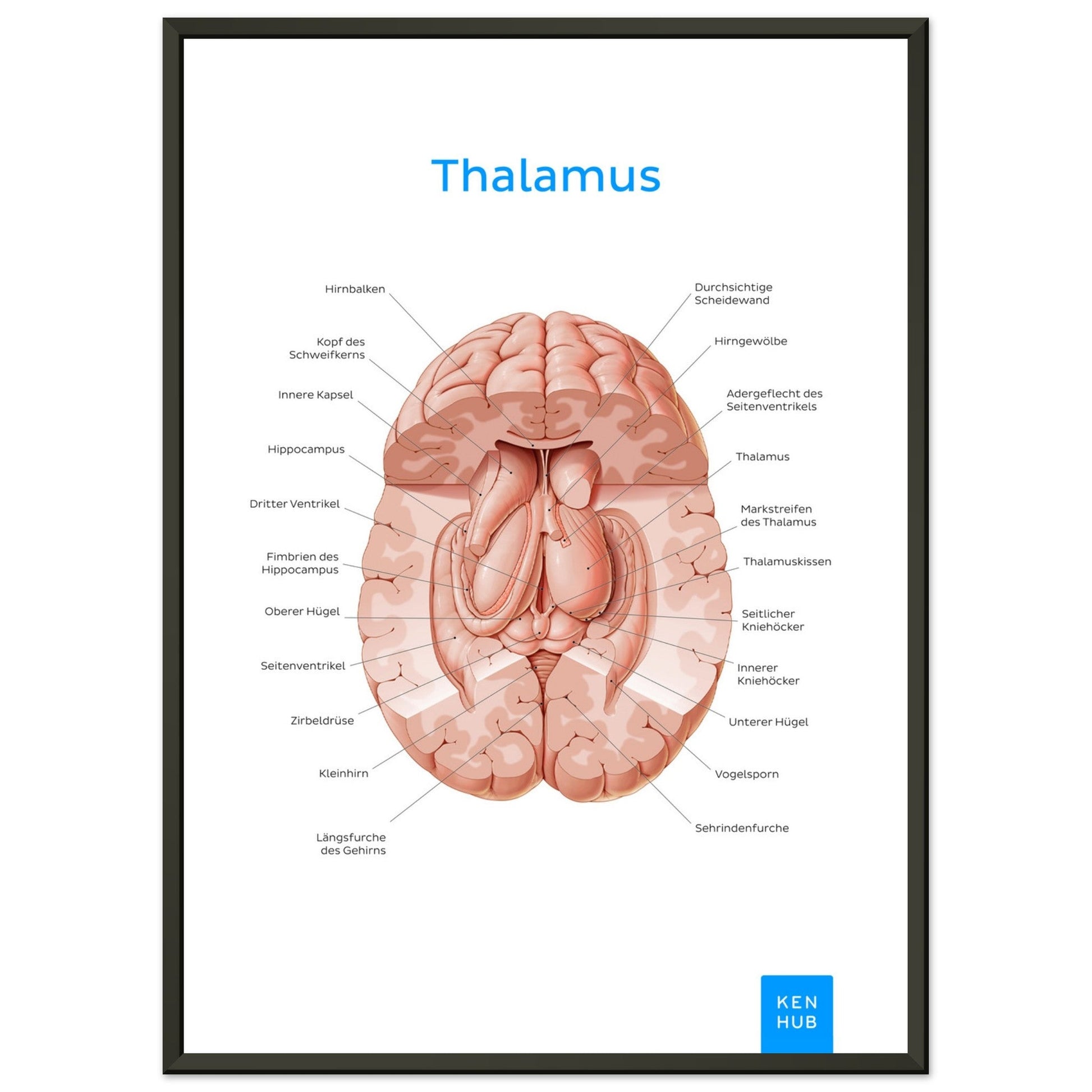 Thalamus (Deutsch) #poster# by ARTEXPRESSO