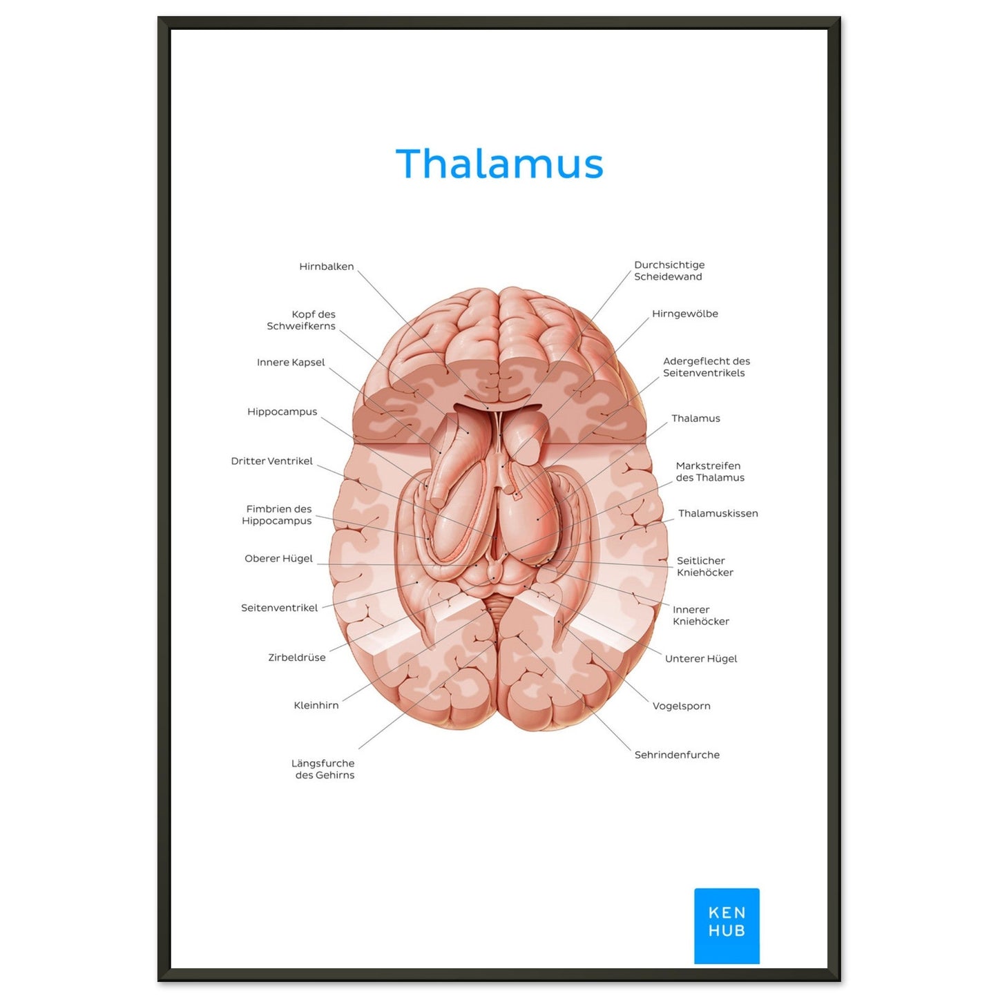 Thalamus (Deutsch) #poster# by ARTEXPRESSO