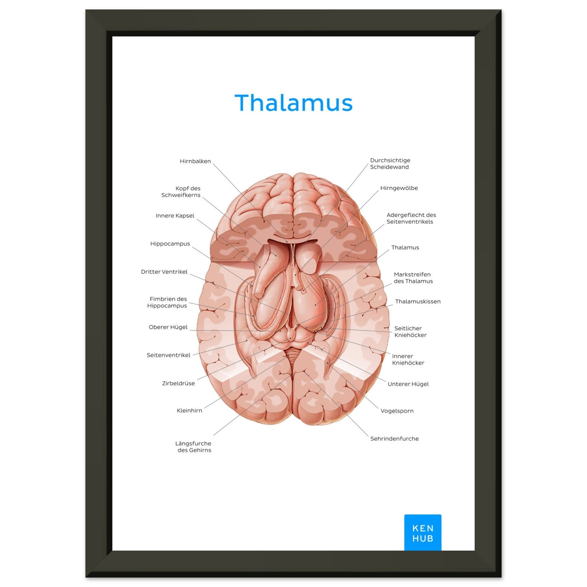 Thalamus (Deutsch) #poster# by ARTEXPRESSO